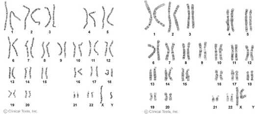 Женский и мужской наборы хромосом