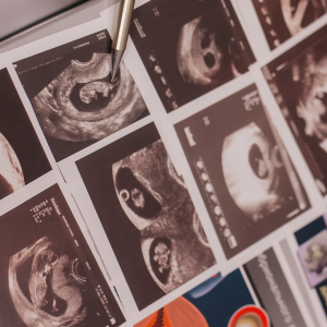 скидка на ЭКО