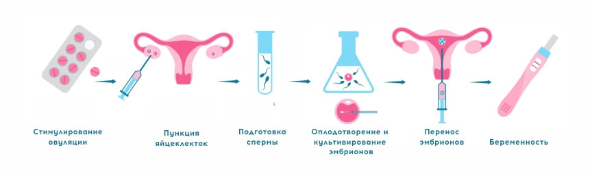 страница ЭКО для иногородних пациентов_2.jpg