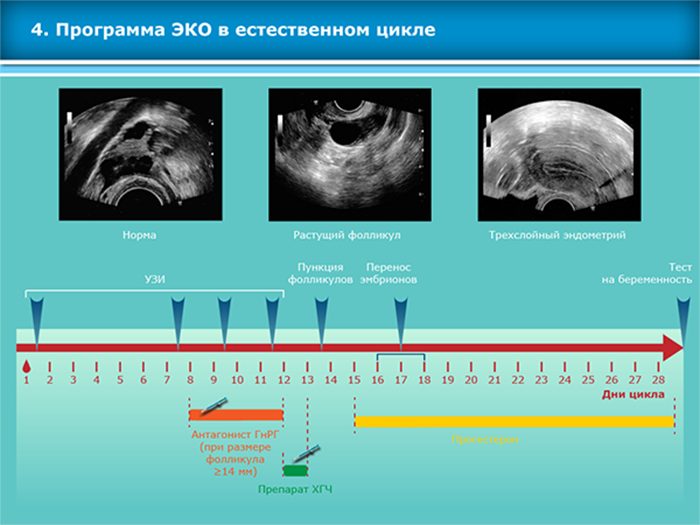 сколько дней длится стимуляция при эко до пункции. Смотреть фото сколько дней длится стимуляция при эко до пункции. Смотреть картинку сколько дней длится стимуляция при эко до пункции. Картинка про сколько дней длится стимуляция при эко до пункции. Фото сколько дней длится стимуляция при эко до пункции