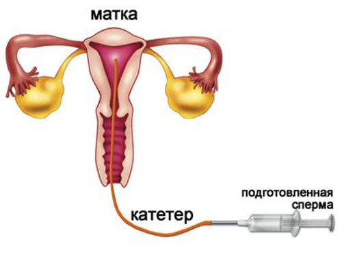 Предэякулят — Википедия