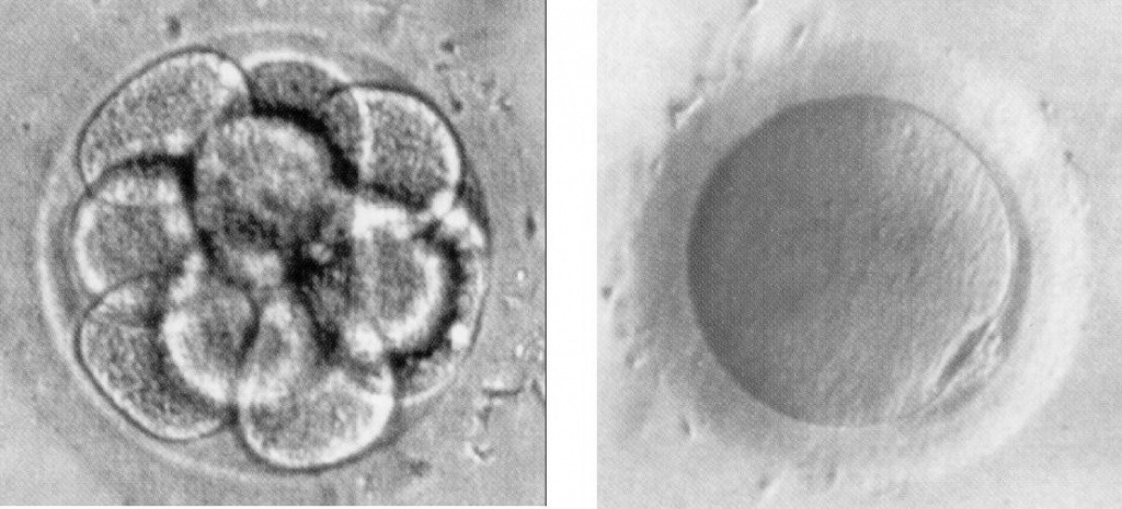 а – эмбрион на стадии 8 клеток (3-и сутки), б – полярное тельце