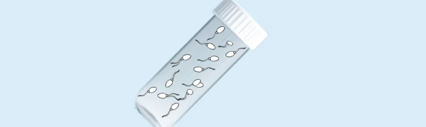 Тератозооспермия