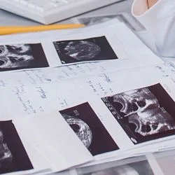 Короткий протокол ЭКО