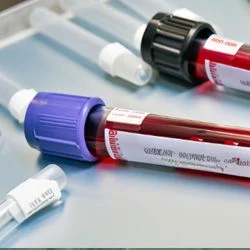 Анализы, которые столь же бесполезны, сколь и популярны.