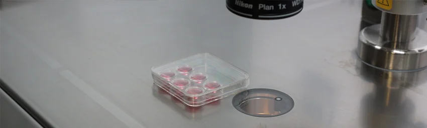 ЭКО с минимальной стимуляцией яичников