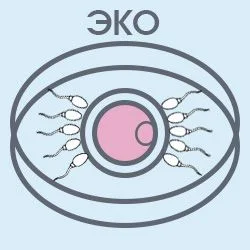 Что же такое ЭКО?