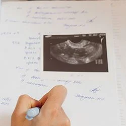 Биохимическая беременность