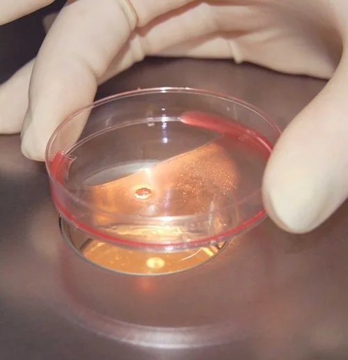 Подготовка к имплантации. С чем связан успех имплантации?