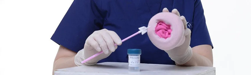 Лечение цервицита шейки матки