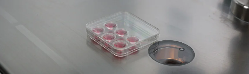 Экстракорпоральное оплодотворение