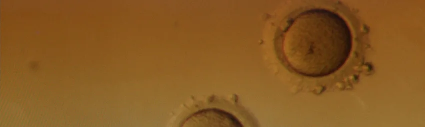 Замораживание яйцеклеток