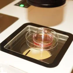 Подготовка к имплантации. С чем связан успех имплантации?