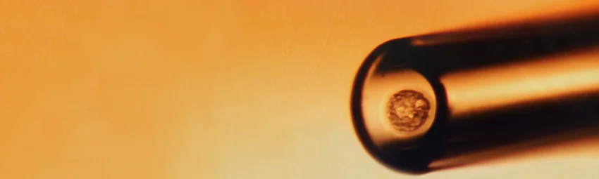 Криоконсервация эмбрионов