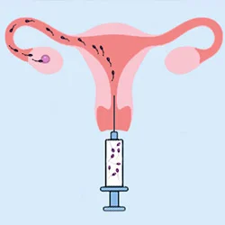 Сколько раз можно делать инсеминацию