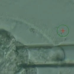 Преимплантационная генетическая диагностика Преимплантационная генетическая диагностика