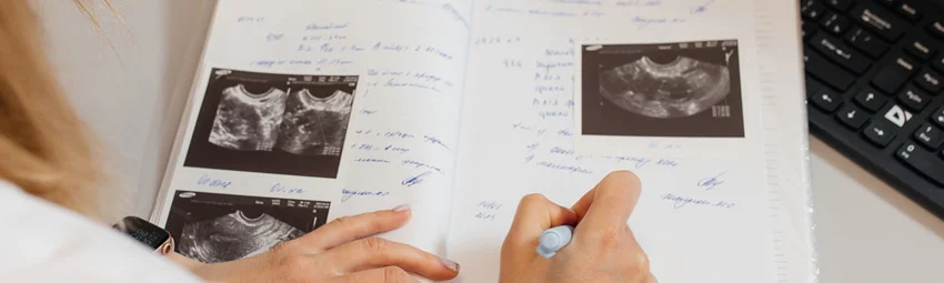 Фолликулометрия